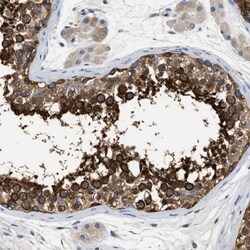 PPP2R1B Antibody, Novus Biologicals:Antibodies:Primary Antibodies