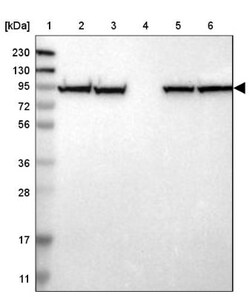 PPP2R1B Antibody, Novus Biologicals:Antibodies:Primary Antibodies