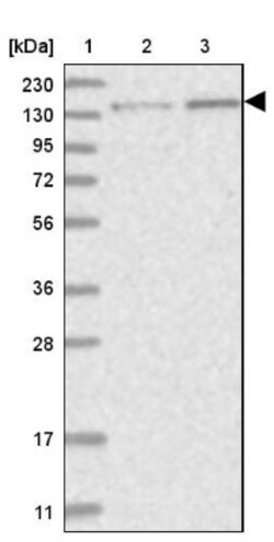 PPP2R3A Antibody, Novus Biologicals:Antibodies:Primary Antibodies