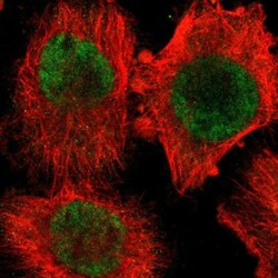 PPP2R4 Antibody, Novus Biologicals 0.1mL; Unlabeled:Antibodies, Polyclonal