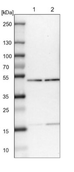 PPP2R4 Antibody, Novus Biologicals 0.1mL; Unlabeled:Antibodies, Polyclonal