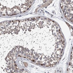 PPP2R5D Antibody, Novus Biologicals 25 &mu;L; Unlabeled:Antibodies, Polyclonal
