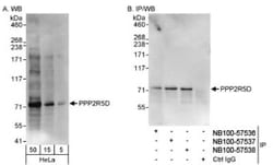 PPP2R5D Antibody, Novus Biologicals 0.1mL; Unlabeled:Antibodies, Polyclonal