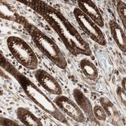 PPP2R5E Antibody, Novus Biologicals:Antibodies:Primary Antibodies