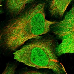 PP4/PPP4C Antibody, Novus Biologicals 0.1mL; Unlabeled:Antibodies, Polyclonal