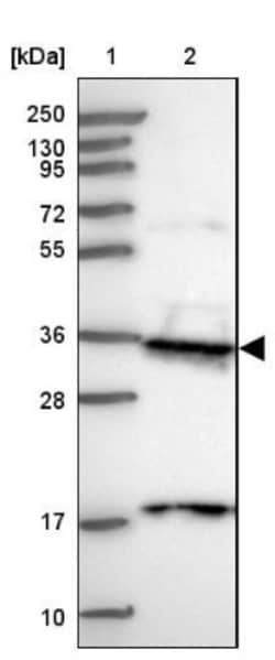 PP4/PPP4C Antibody, Novus Biologicals 0.1mL; Unlabeled:Antibodies, Polyclonal