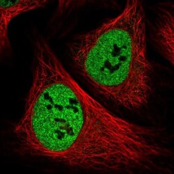 PPP4R1 Antibody, Novus Biologicals 0.1mL; Unlabeled:Antibodies, Polyclonal