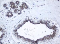 PPT1 Antibody (OTI1F10), Novus Biologicals 0.1mL; Unlabeled:Antibodies,