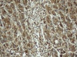 PPT1 Antibody (OTI1F10), Novus Biologicals 0.1mL; Unlabeled:Antibodies,