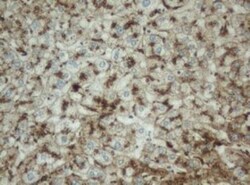 PPT1 Antibody (OTI1F10), Novus Biologicals 0.1mL; Unlabeled:Antibodies,