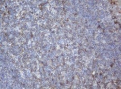 PPT1 Antibody (OTI1F10), Novus Biologicals 0.1mL; Unlabeled:Antibodies,