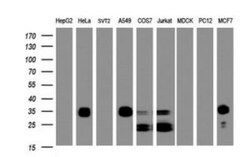PPT1 Antibody (OTI1F10), Novus Biologicals 0.1mL; Unlabeled:Antibodies,