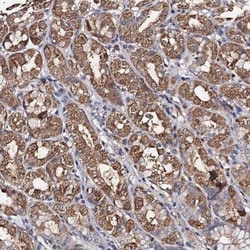 PPTC7 Antibody, Novus Biologicals 0.1mL; Unlabeled:Antibodies, Polyclonal