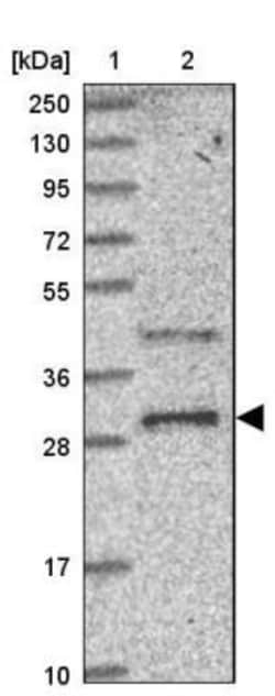 PPTC7 Antibody, Novus Biologicals 0.1mL; Unlabeled:Antibodies, Polyclonal