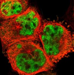 PQBP1 Antibody, Novus Biologicals 25 &mu;L; Unlabeled:Antibodies, Polyclonal