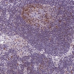 PQLC1 Antibody, Novus Biologicals:Antibodies:Primary Antibodies