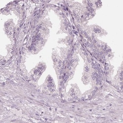 PRAME Antibody, Novus Biologicals:Antibodies:Primary Antibodies