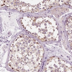 PRAME Antibody, Novus Biologicals:Antibodies:Primary Antibodies
