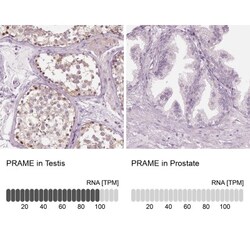 PRAME Antibody, Novus Biologicals:Antibodies:Primary Antibodies