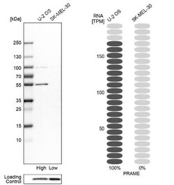 PRAME Antibody, Novus Biologicals:Antibodies:Primary Antibodies