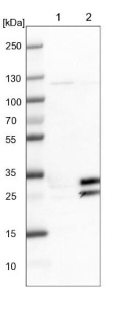 PRAT4B/CNPY4 Antibody, Novus Biologicals 0.1mL; Unlabeled:Antibodies, Polyclonal