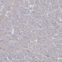 PRC1 Antibody, Novus Biologicals 25 &mu;L; Unlabeled:Antibodies, Polyclonal