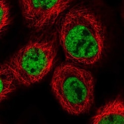 PRCC Antibody, Novus Biologicals:Antibodies:Primary Antibodies