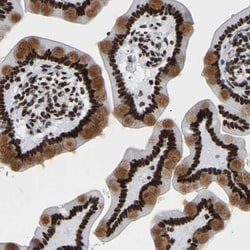 PRCC Antibody, Novus Biologicals:Antibodies:Primary Antibodies