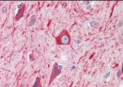 PRDM11 Antibody, Novus Biologicals 0.1mg; Unlabeled:Antibodies, Polyclonal