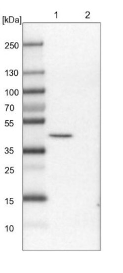 PRDM12 Antibody, Novus Biologicals 0.1mL; Unlabeled:Antibodies, Polyclonal