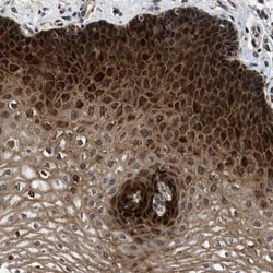 Myosin Light Chain 2 Antibody, Novus Biologicals:Antibodies:Primary Antibodies
