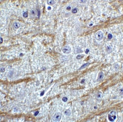 PRDM16/MEL1 Antibody - BSA Free, Novus Biologicals 0.025 mg, Unconjugated:Antibodies,