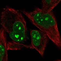 PRDM5 Antibody, Novus Biologicals:Antibodies:Primary Antibodies