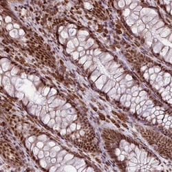 PRDM5 Antibody, Novus Biologicals:Antibodies:Primary Antibodies
