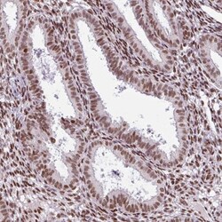 PRDM5 Antibody, Novus Biologicals:Antibodies:Primary Antibodies