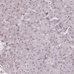 PRDM5 Antibody, Novus Biologicals:Antibodies:Primary Antibodies