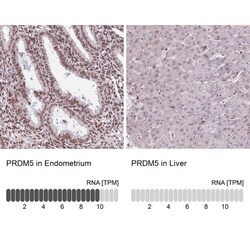 PRDM5 Antibody, Novus Biologicals:Antibodies:Primary Antibodies