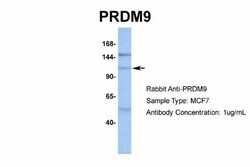 PRDM9 Antibody, Novus Biologicals 0.05mg; Unlabeled:Antibodies, Polyclonal