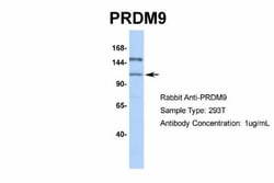 PRDM9 Antibody, Novus Biologicals 0.05mg; Unlabeled:Antibodies, Polyclonal