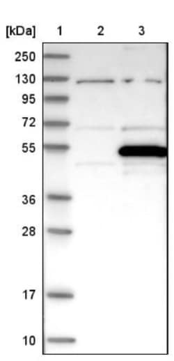PREB Antibody, Novus Biologicals 0.1mL; Unlabeled:Antibodies, Polyclonal