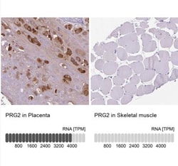PRG2 Antibody, Novus Biologicals 0.1mL; Unlabeled:Antibodies, Polyclonal