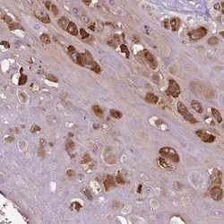 PRG2 Antibody, Novus Biologicals 0.1mL; Unlabeled:Antibodies, Polyclonal