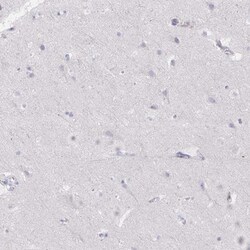 PRG3 Antibody, Novus Biologicals 0.1 mL | Buy Online | Novus Biologicals | Fisher Scientific