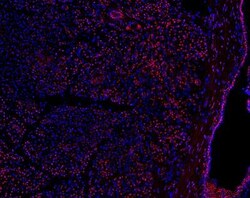 PRICKLE1 Antibody, Novus Biologicals 0.1mL; Unlabeled:Antibodies, Polyclonal
