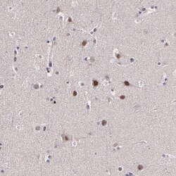 PRICKLE1 Antibody, Novus Biologicals 0.1mL; Unlabeled:Antibodies, Polyclonal