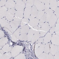 PRICKLE1 Antibody, Novus Biologicals 0.1mL; Unlabeled:Antibodies, Polyclonal