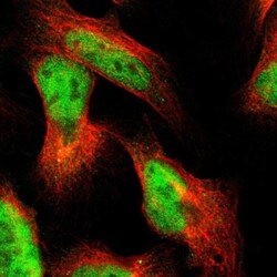 PRKAG2 Antibody, Novus Biologicals:Antibodies:Primary Antibodies
