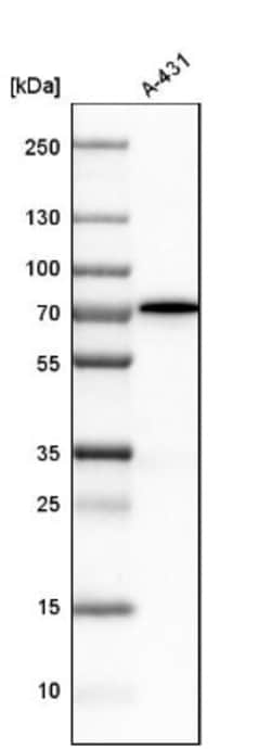 PRKAG2 Antibody, Novus Biologicals:Antibodies:Primary Antibodies