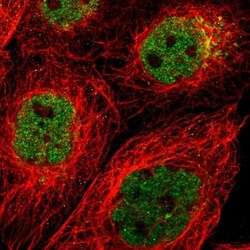 PRKCBP1 Antibody, Novus Biologicals 0.1mL; Unlabeled:Antibodies, Polyclonal