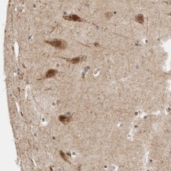 PRKCBP1 Antibody, Novus Biologicals 0.1mL; Unlabeled:Antibodies, Polyclonal